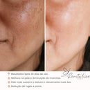 Massageador Facial de Led - Revitalize Plus® - Tempore Plus